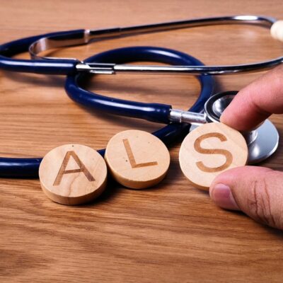 Initial warning signs of ALS in women