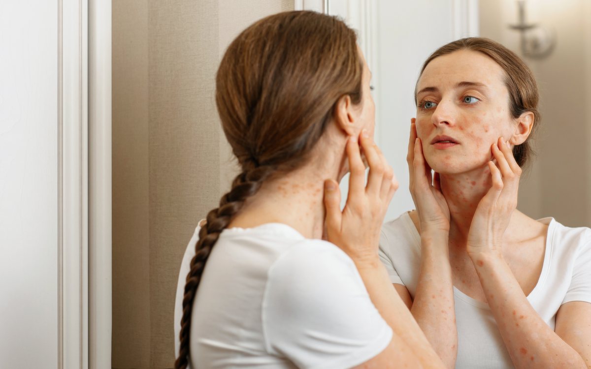 7 skin conditions and ways to manage them